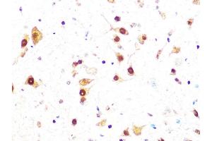 Immunohistochemistry of paraffin-embedded mouse spinal cord using Casein Kinase 2 beta (CSNK2B) (CSNK2B) Rabbit mAb (ABIN1680593, ABIN3019007, ABIN3019008 and ABIN7101698) at dilution of 1:100 (40x lens). (CSNK2B antibody)