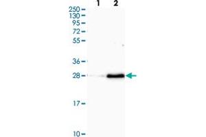 Western blot analysis of Lane 1: Human cell line RT-4 Lane 2: Human cell line U-251MG sp with OIP5 polyclonal antibody  at 1:100-1:250 dilution.