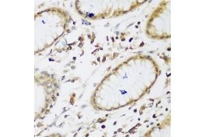 Immunohistochemistry of paraffin-embedded human gastric using UBE3A antibody (ABIN5975332) at dilution of 1/200 (40x lens).
