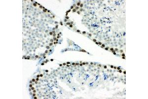 Immunohistochemistry (IHC) image for anti-Minichromosome Maintenance Complex Component 7 (MCM7) (AA 526-719) antibody (ABIN3043877)
