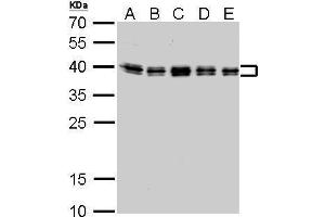 WB Image hnRNP C1/C2 antibody detects HNRNPC protein by Western blot analysis. (HNRNPC antibody)