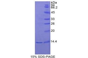 SDS-PAGE analysis of Rat Inhibin beta E Protein.
