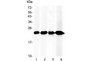 Western blot testing of 1) mouse liver, 2) rat liver, 3) human placenta and 4) human HepG2 lysate with RBP4 antibody at 0.