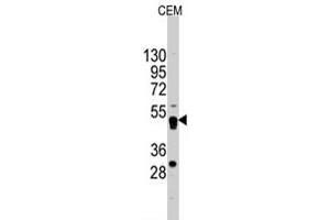 Western blot analysis of GATA4 polyclonal antibody  in CEM cell line lysates (35 ug/lane). (GATA4 antibody  (C-Term))