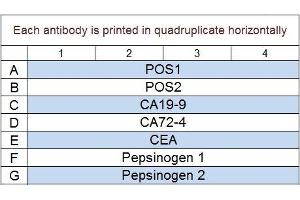 Image no. 1 for Human Gastric Cancer Biomarker Array Q1 (ABIN4956063) (Human Gastric Cancer Biomarker Array Q1)
