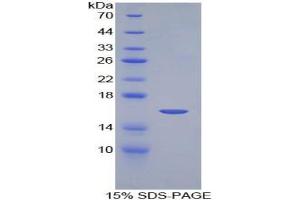 SDS-PAGE analysis of Mouse NRARP Protein. (NRARP Protein)