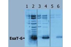 Western Blotting (Mycobacterium Tuberculosis Antigen EsaT-6 (Rv3875) antibody)