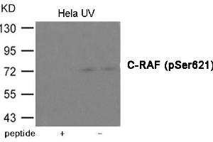 Western blot analysis of extracts from Hela cells treated with UV using C-RAF (Phospho-Ser621) Antibody. (RAF1 antibody  (pSer621))