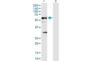 Western Blot analysis of TRAF6 expression in transfected 293T cell line by TRAF6 MaxPab polyclonal antibody. (TRAF6 antibody  (AA 1-522))