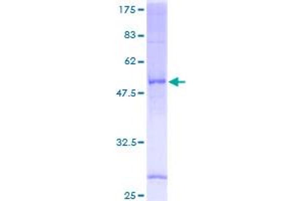 SRD5A1 Protein (AA 1-259) (GST tag)