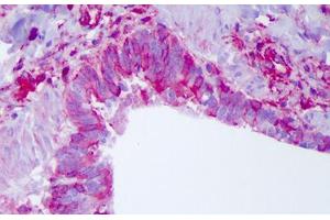 Human Lung: Formalin-Fixed, Paraffin-Embedded (FFPE) (NLRP11 antibody  (C-Term))