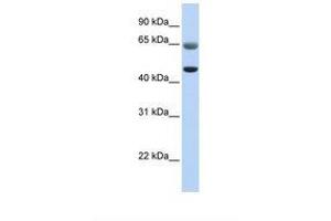 Image no. 1 for anti-Family with Sequence Similarity 113, Member A (FAM113A) (AA 326-375) antibody (ABIN6738457) (FAM113A antibody  (AA 326-375))