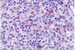 Anti-CCRL2 antibody  ABIN1048410 IHC staining of human spleen. (CCRL2 antibody  (Cytoplasmic Domain))