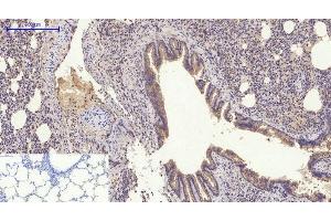 Immunohistochemistry of paraffin-embedded Rat lung tissue using GLUT-4 Polyclonal Antibody at dilution of 1:200. (GLUT4 antibody)