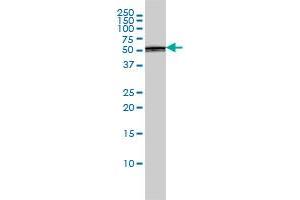 PTBP1 monoclonal antibody (M01), clone 3H8 Western Blot analysis of PTBP1 expression in A-431 . (PTBP1 antibody  (AA 45-144))