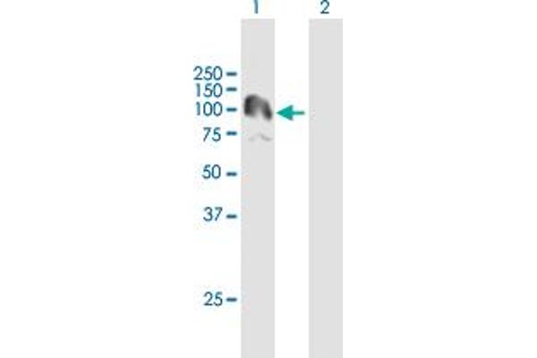 PKN3 antibody  (AA 1-889)