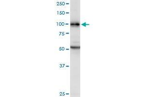 Western Blotting (WB) image for anti-Disabled Homolog 2, Mitogen-Responsive phosphoprotein (Drosophila) (DAB2) (AA 1-770) antibody (ABIN514859)