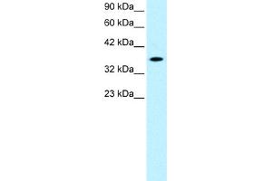 WB Suggested Anti-RAX Antibody Titration:  0.
