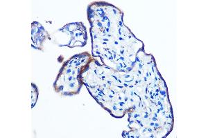 Immunohistochemistry of paraffin-embedded human placenta using IKKε Rabbit mAb (ABIN7267875) at dilution of 1:100 (40x lens). (IKKi/IKKe antibody)
