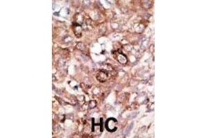 Immunohistochemistry (IHC) image for anti-BCL2-Associated Agonist of Cell Death (BAD) (BH3 Domain) antibody (ABIN2997223) (BAD antibody  (BH3 Domain))