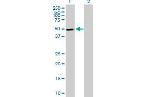 Western Blot analysis of ZNF383 expression in transfected 293T cell line by ZNF383 MaxPab polyclonal antibody. (ZNF383 antibody  (AA 1-475))
