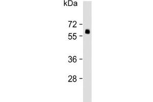 Western blot testing of human lung lysate with SMAD6 antibody. (SMAD6 antibody  (AA 358-386))