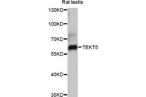 Western blot analysis of extracts of rat testis, using TEKT5 antibody (ABIN5999026) at 1:3000 dilution.