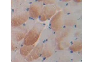 Figure. (ALOX5 antibody  (AA 223-410))
