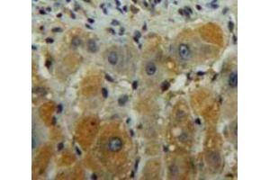 Used in DAB staining on fromalin fixed paraffin-embedded Liver tissue (DGKG antibody  (AA 451-698))