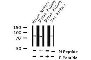 Western blot analysis of Phospho-C-RAF (Ser338) expression in various lysates (RAF1 antibody  (pSer338))