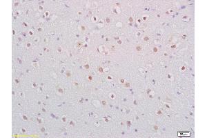 Formalin-fixed and paraffin embedded rat brain labeled with Anti-BDNF Polyclonal Antibody, Unconjugated (ABIN1387788) at 1:200 followed by conjugation to the secondary antibody and DAB staining. (BDNF antibody  (AA 151-247))