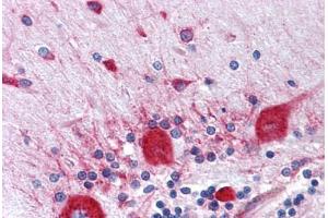 Human Brain, Cerebellum: Formalin-Fixed, Paraffin-Embedded (FFPE) (RPS2 antibody  (AA 198-294))