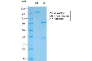 SDS-PAGE Analysis Purified Multi-Cytokeratin Rabbit Monoclonal Antibody (KRT/1877R). (Recombinant Cytokeratin, Multi (Epithelial Marker) antibody)
