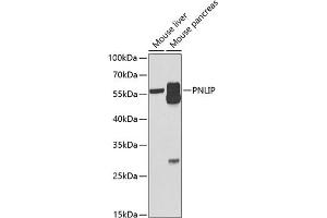 Western blot analysis of extracts of various cell lines, using PNLIP antibody (ABIN6128521, ABIN6145838, ABIN6145840 and ABIN6222025) at 1:1000 dilution. (PNLIP antibody  (AA 166-465))