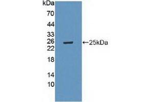 Western blot analysis of recombinant Mouse LAMa4. (LAMa4 antibody  (AA 745-940))