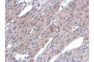 IHC-P Image Immunohistochemical analysis of paraffin-embedded U87 xenograft, using ASL, antibody at 1:500 dilution. (ASL antibody)