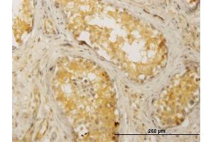 Immunoperoxidase of monoclonal antibody to CDC42BPB on formalin-fixed paraffin-embedded human testis. (CDC42BPB antibody  (AA 1580-1679))