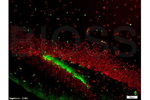 Formalin-fixed and paraffin embedded mouse brain labeled with Anti-NeuN Polyclonal Antibody, Unconjugated (ABIN732068) at 1:200 followed by conjugation to the secondary antibody and DAB staining (NeuN antibody  (AA 51-150))