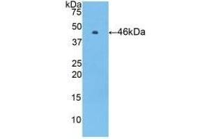 Detection of Recombinant PROC, Human using Polyclonal Antibody to Protein C (PROC) (PROC antibody)