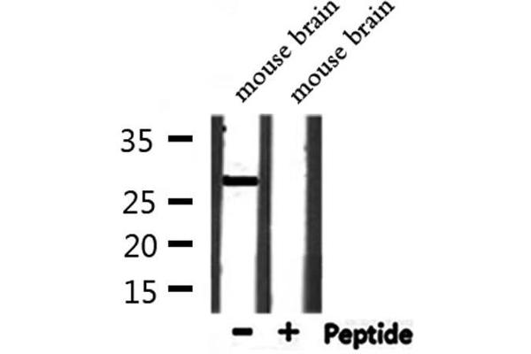 OAZ3 antibody  (Internal Region)