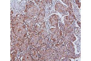IHC analysis of HSPH1 using anti-HSPH1 antibody (ABIN7602237).