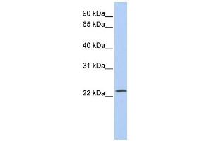 PIP5KL1 antibody used at 1 ug/ml to detect target protein. (PIP5KL1 antibody  (Middle Region))