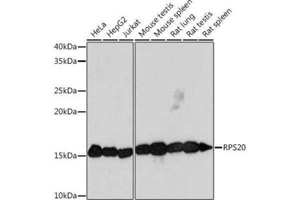 RPS20 antibody