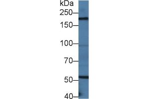 Detection of LAMb2 in Mouse Small intestine lysate using Polyclonal Antibody to Laminin Beta 2 (LAMb2) (LAMB2 antibody  (AA 1498-1716))