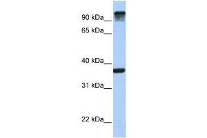 WB Suggested Anti-EPS15  Antibody Titration: 0. (EPS15 antibody  (C-Term))