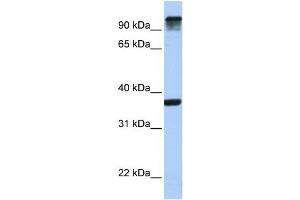 WB Suggested Anti-EPS15  Antibody Titration: 0.