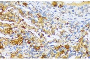 Immunohistochemistry of paraffin-embedded Rat ovary using A1CF Polyclonal Antibody at dilution of 1:100 (40x lens).