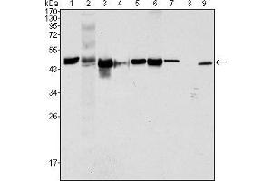 Western blot analysis using CK18 mouse mAb against Hela (1), NIH/3T3 (2), A549 (3), Jurkat (4), MCF-7(5), HepG2 (6), A431 (7), HEK293 (8) and K562 (9) cell lysate. (Cytokeratin 18 antibody  (AA 391-483))