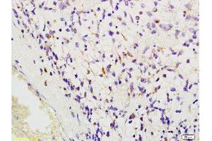 Immunohistochemistry (Paraffin-embedded Sections) (IHC (p)) image for anti-Macrophage Scavenger Receptor 1 (MSR1) (AA 211-320) antibody (ABIN872905)