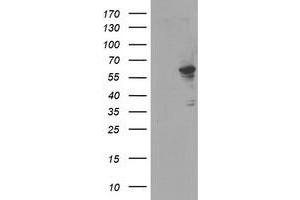 HEK293T cells were transfected with the pCMV6-ENTRY control (Left lane) or pCMV6-ENTRY FTCD (Right lane) cDNA for 48 hrs and lysed. (FTCD antibody)